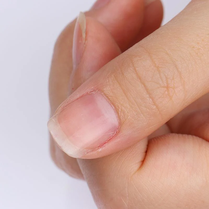 10 Pads Gel Polish Remover - Image 9