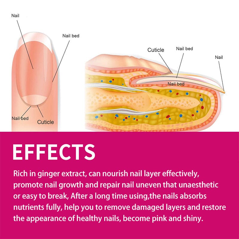 Ginger Nail Essence Repair Fungus Treatment 10ml - Image 8