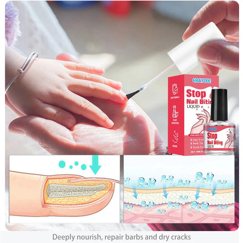 Stop Nail Biting Liquid 10ml - Image 3