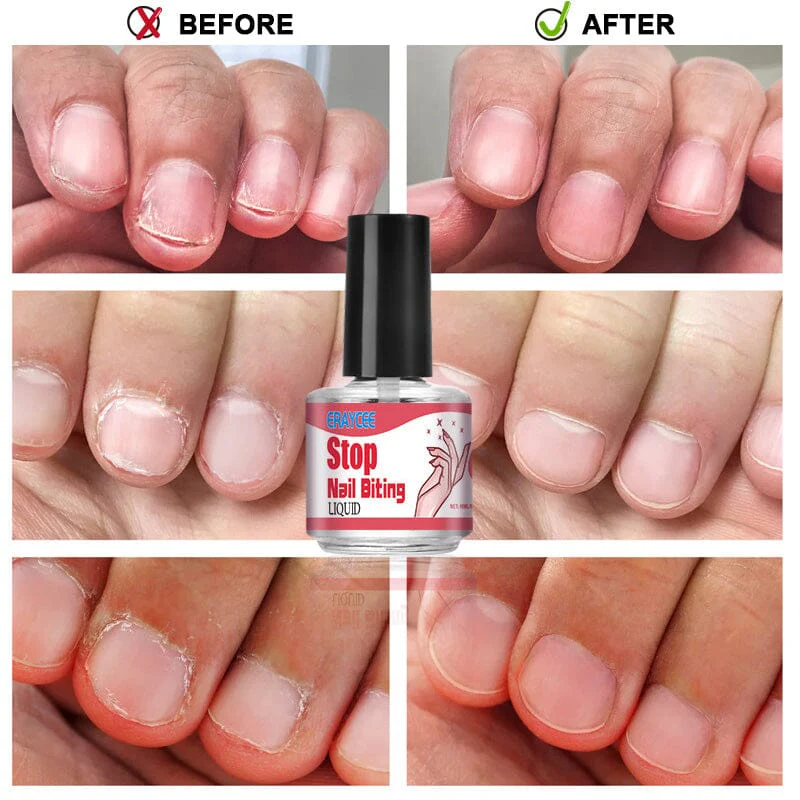 Stop Nail Biting Liquid 10ml - Image 7